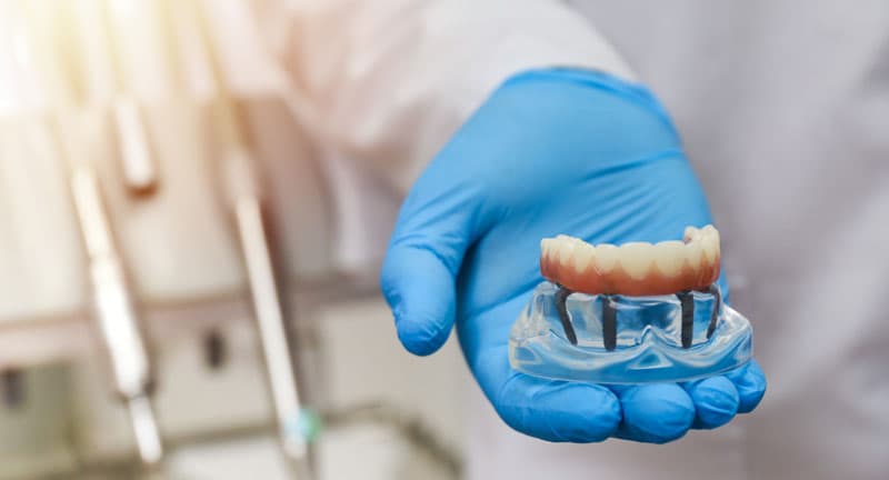 Implantes dentales vigo